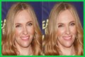 Toni Collette Teeth Before And After | What Is Wrong With Her Face